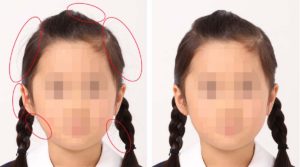 髪ハネ修整サンプル