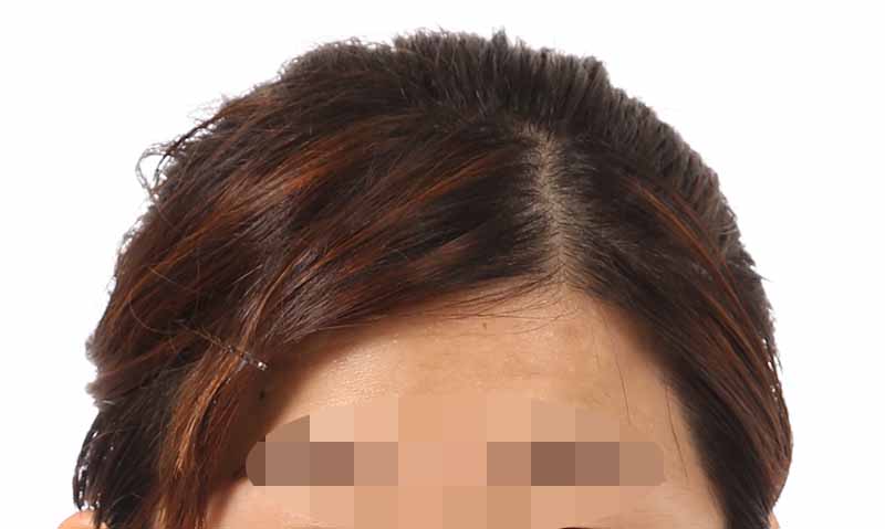 証明写真の修整事例(メッシュ状の髪色修整)